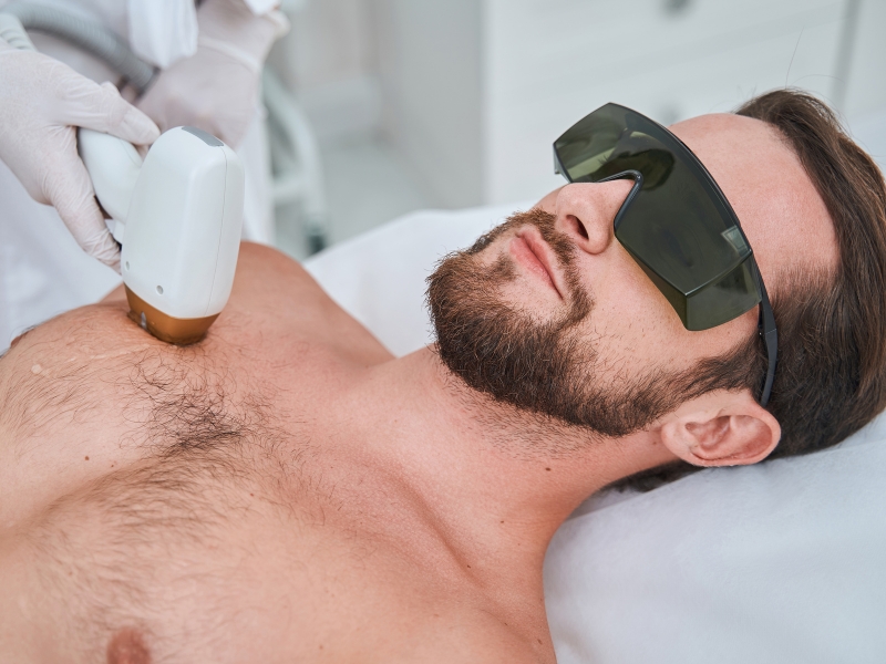 USUWANIE OWŁOSIENIA