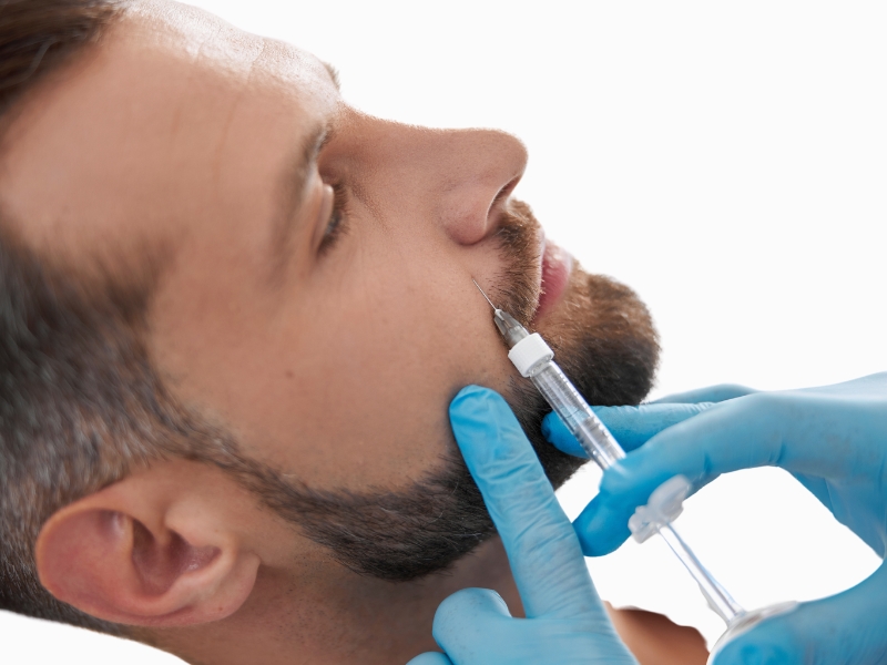 wypełnienie zmarszczek