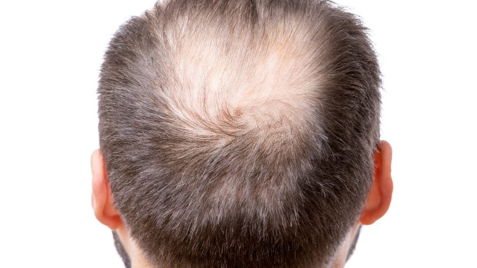 KARBOKSYTERAPIA DLA MĘŻCZYZN