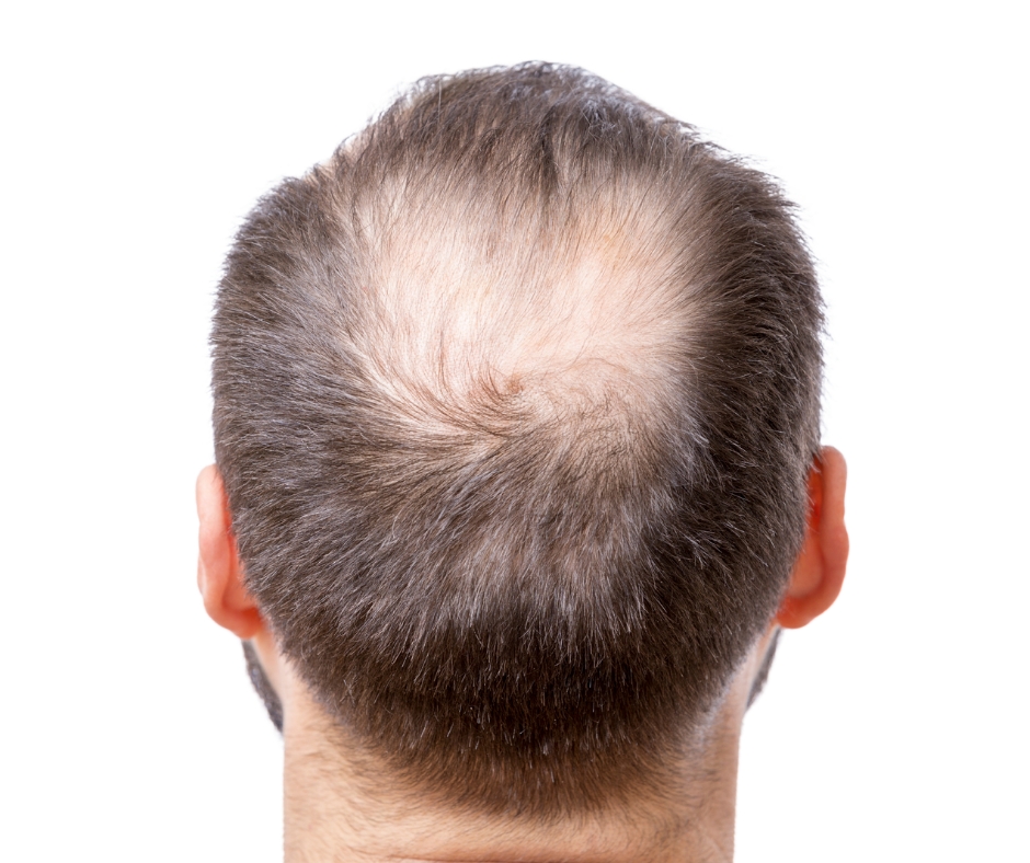 KARBOKSYTERAPIA DLA MĘŻCZYZN